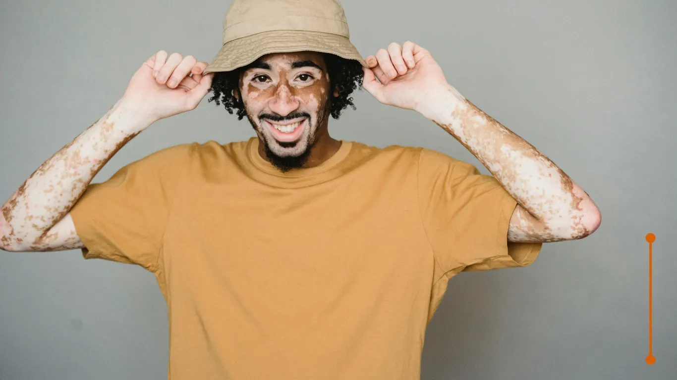 Imagen de Cuerpo relacionada con el tratamiento de psoriasis